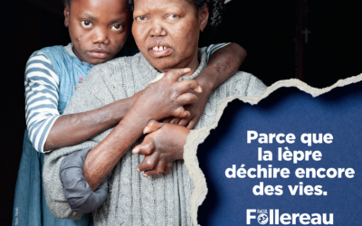 Journées mondiales contre la lèpre : concert et quête
